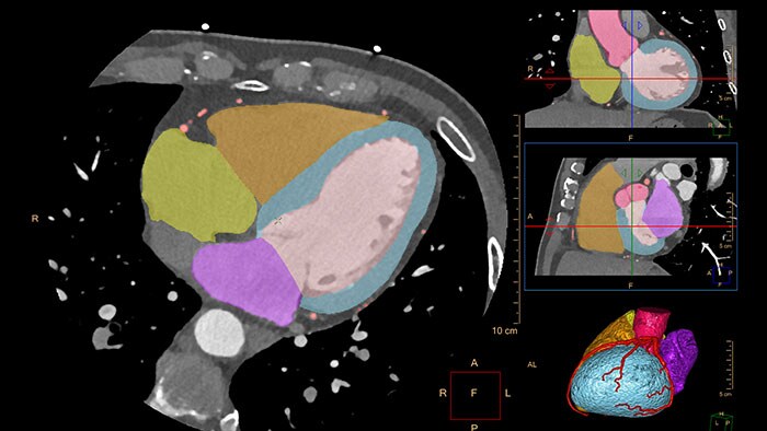 comprehensive cardiac analysis thumbnail