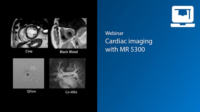 Cardiac imaging at Hospital Sagrat Cor and Hospital Sant Pau in Barcelona