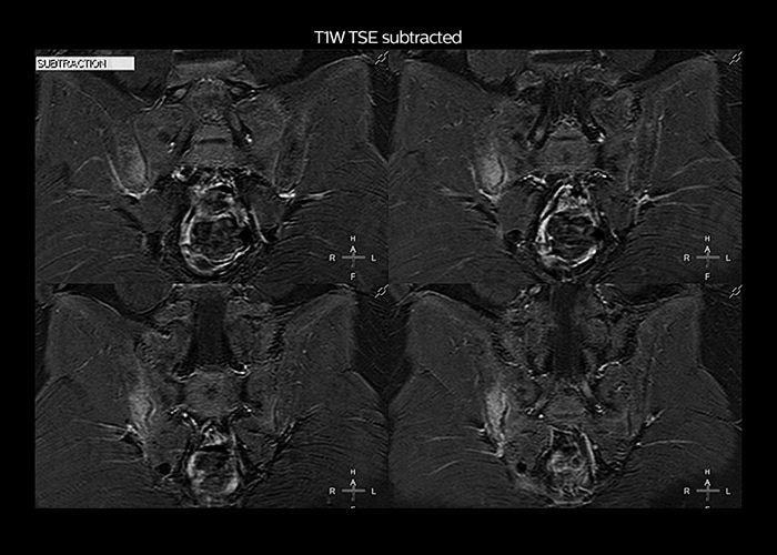 clinical cases tab2 image