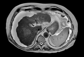 MCVI VitalEye abdomen