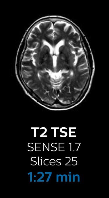 T2 TSE