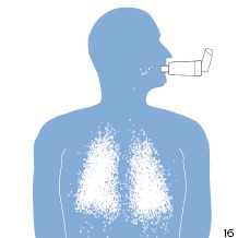 Utilizarea unui inhalator cu cameră de retentie.