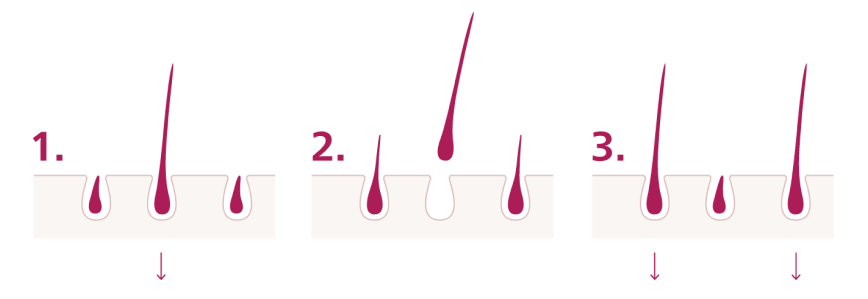 Why does it take a few weeks to work?