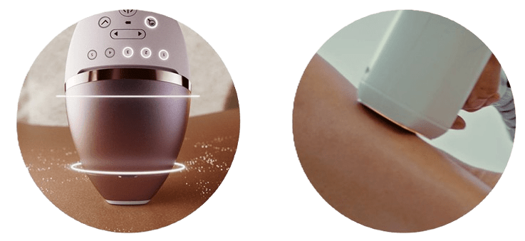 Why Lumea is better than other epilation methods