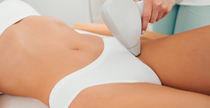 Groin hair removal with IPL